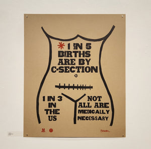 C-Section