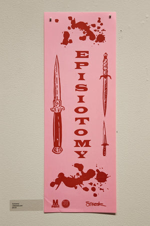 Episiotomy